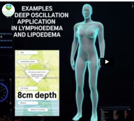 Deep Oscillation Application in Lymphoedema and Lipoedema